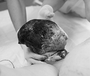 Photo series “The birth of the head”