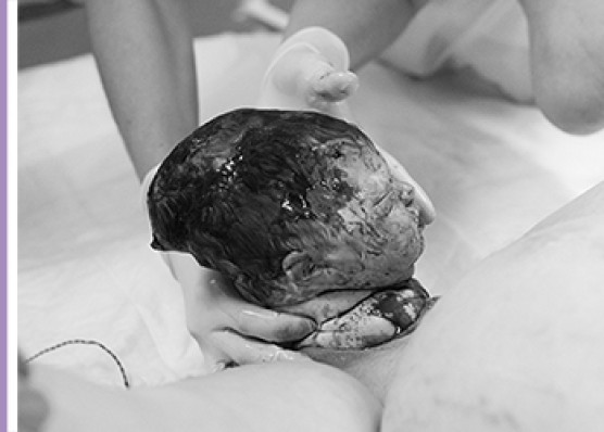 Fotoserie “De geboorte van het hoofdje”